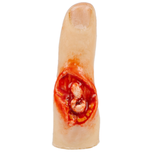 TraumaSim Finger Glove - Exposed Bone Injury